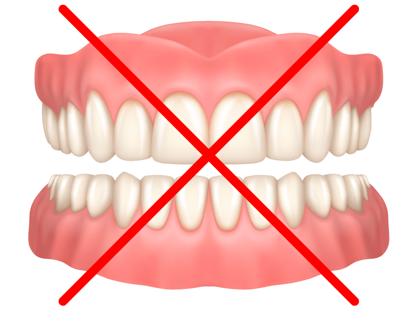 La dentiera non è la soluzione